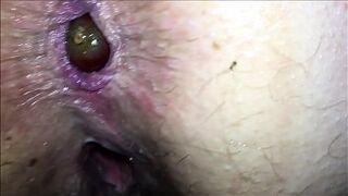 Honey adolescent insertions fruits deep inside her stretched anus then pop them out showing her anal turning inside out as they pops out