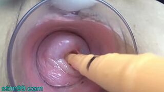 Japanese Mature Cervix Fucking with German real dick fake cock and asian chopsticks